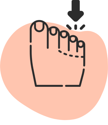 Ortesis de silicona en Manzanares