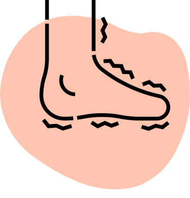 Tratamiento para el pie diabético en Manzanares