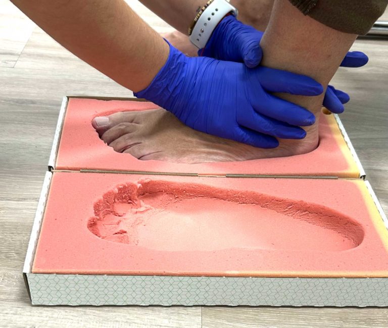 Estudio biomecánico de la pisada y plantillas personalizadas en Manzanares